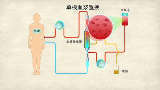 tpe醫學上是什么意思 tpe到底有幾種含義
